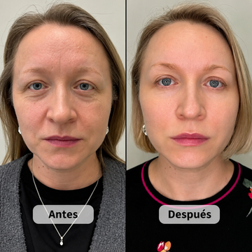 NatuPlump PDRN Collagen Volume Balm