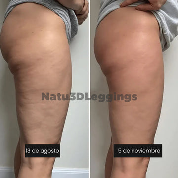 NatuLeggings 3D - Reductor de celulitis
