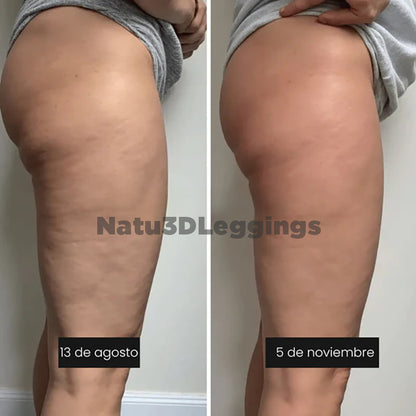 NatuLeggings™ 3D - Reductor de celulitis