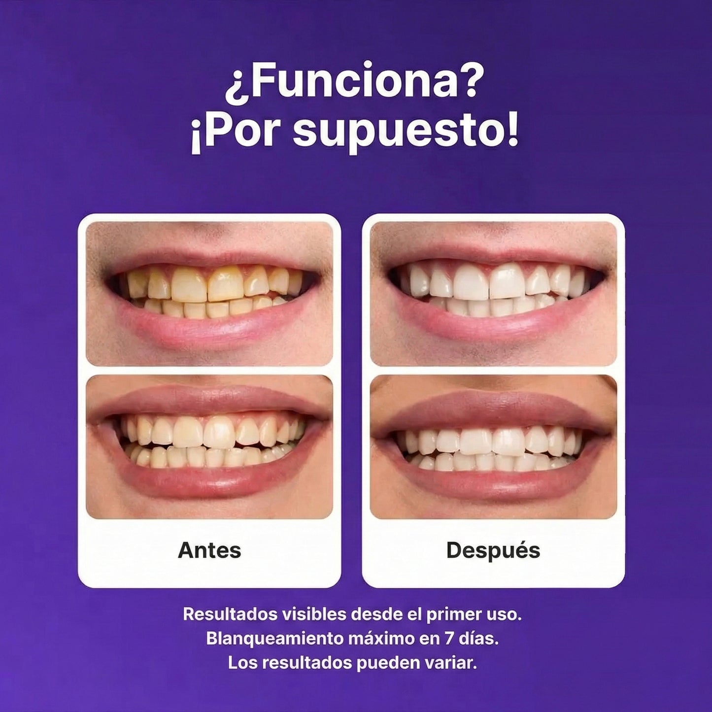 NatuSmile™ - Tiras blanqueadoras para dientes