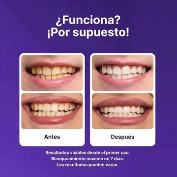 NatuSmile Teeth Whitening Strips